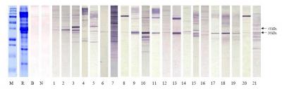 Figure 1: SDS-PAGE and immunoblotting profiles of raw (a) and cooked (b) extracts of mud crab. Lane M indicates molecular weight markers in kiloDalton (kDa). Lane B and N represent a blank and a negative control of a normal serum, respectively. Lane 1 through 21 represents immunoblotting results of sera from 21 patients with mud crab allergy.